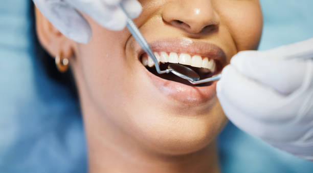 Best Emergency Treatment for Dental Infections or Abscesses in Walnut, CA